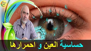 دواء طبيعي لحساسية العين و احمرارها    -   الدكتور كريم العابد العلوي   -