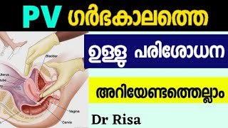 PV in Pregnancy Malayalam | Vaginal Examination in Pregnancy screenshot 2