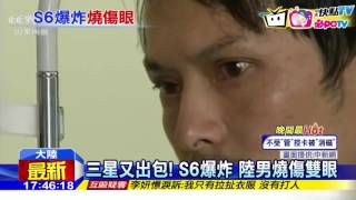 20161031中天新聞　三星又出包！　S6爆炸　陸男燒傷雙眼