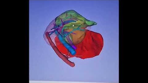Hepatic lobectomy dog, facilitated by 3D reconstruction. Dr Matres, CHV Massilia, Marseille
