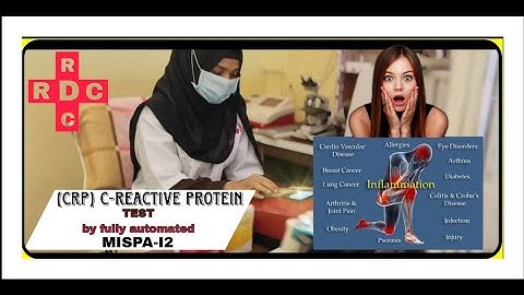 CRP TEST (C-REACTIVE PROTEIN)fully automated MISPA-I2 patelnagar Amberpet Cell;-9000701201