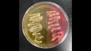 How to Interpret Mannitol Salt Agar Bacterial Growth Medium