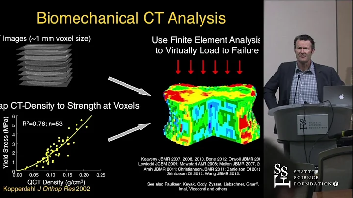 Pre-Operative Bone Strength & BMD Assessment in Spine Fusion Patients by Tony Keaveny, Ph.D.
