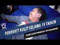 KIRIMAN PENYAKIT KULIT DARI PENGIKUT NYI BLORONG