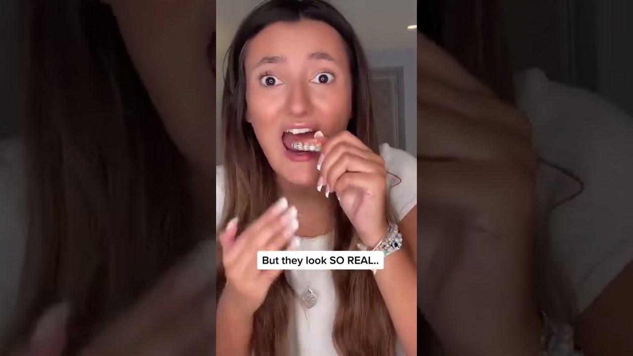 Поддельные брекеты — розыгрыш над моим парнем..