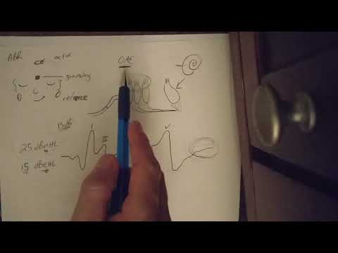 ABR and auditory processing