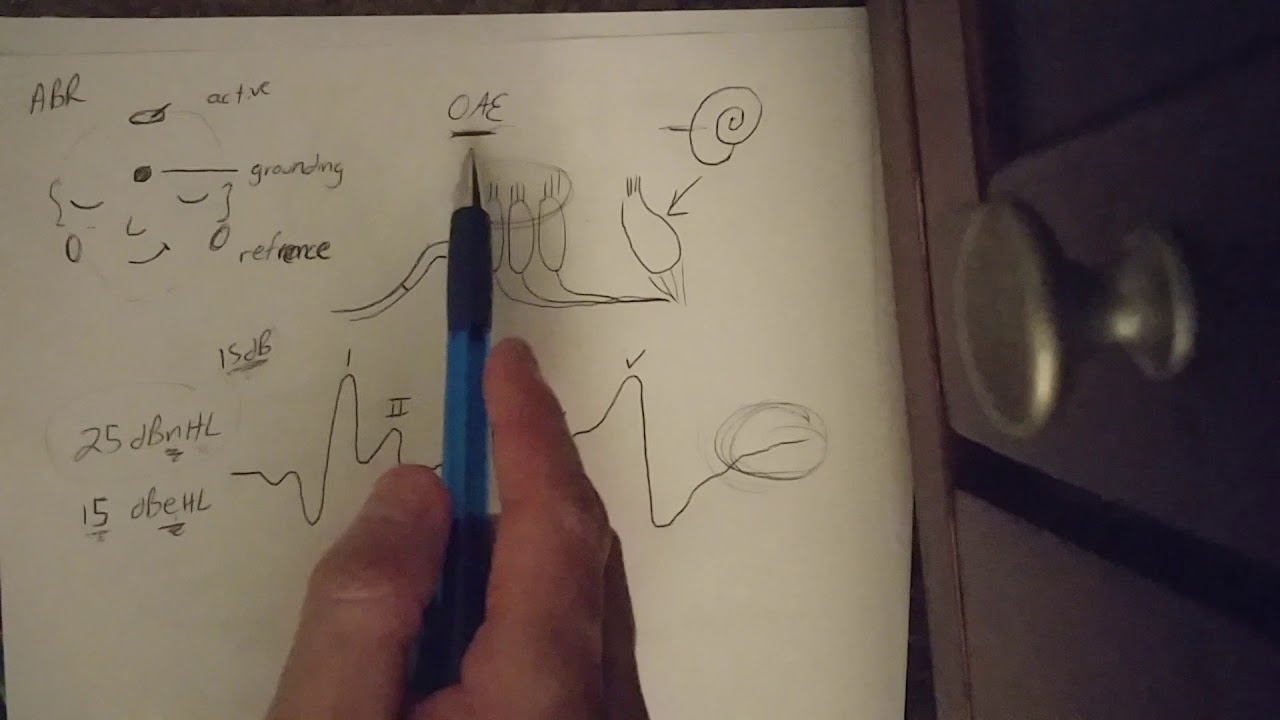 ABR and auditory processing