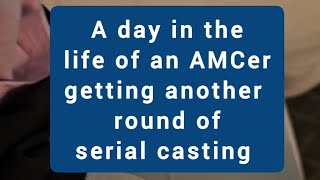 A day in the life of Arthrogryposis serial casting
