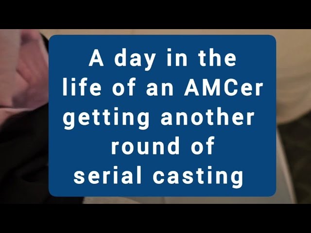 A day in the life of Arthrogryposis serial casting
