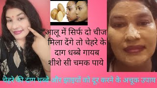 Natural beauty secrets #आलू के फायदे #स्किन lightning #gloskin