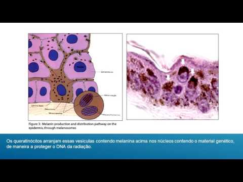 Vídeo: Resposta A Danos No DNA E Terapêutica Do Câncer Através Das Lentes Da Via De Reparo Do DNA Da Anemia De Fanconi