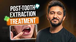 What Happens If You Don’t Replace a Missing Tooth? (Shocking Truth)