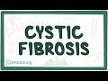 Cystic fibrosis - causes, symptoms, diagnosis, treatment, pathology