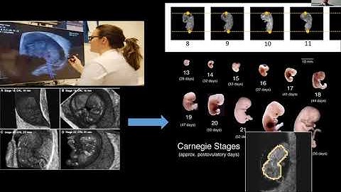 Data management in medical image analysis