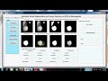 Automatic Breast Segmentation and Cancer Detection via SVM in Mammograms