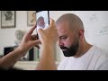 What Is The Process Of Scalp Micropigmentation (SMP) Hair Tattoo? | Foli Sim SMP