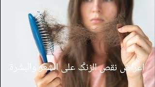 أعراض نقص الزنݣ على الشعر والبشرة