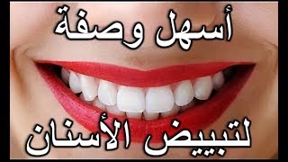 الوصفة السحرية للتبيض الأسنان وإزلة الألم