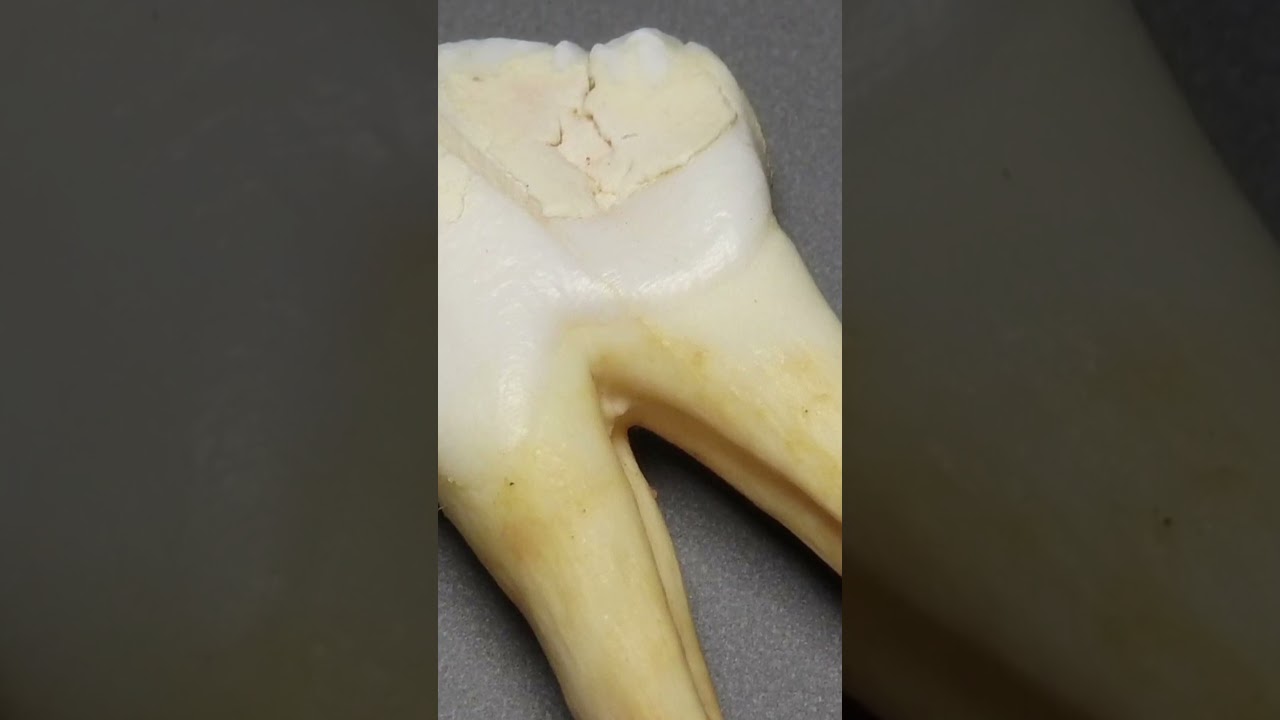 Development of a New Drug to Generate New Teeth!Will People be Able to "Grow" a Set of Teeth