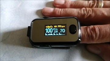 Atrial Fibrillation (AFib) Episode on Pulse Oximeter