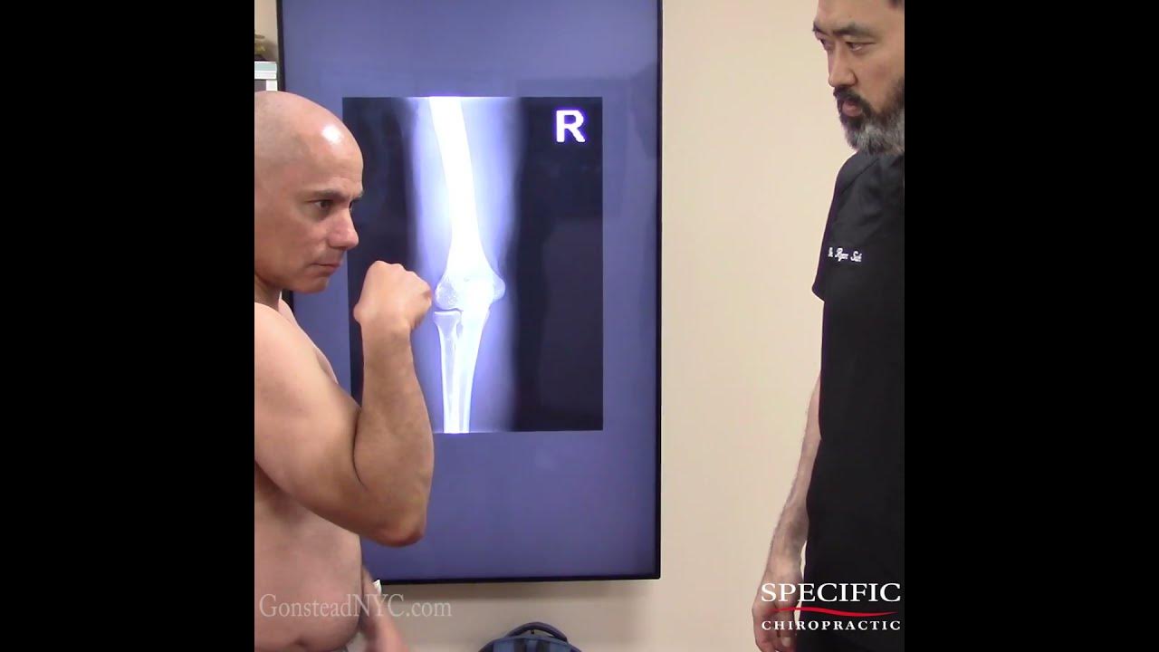 ELBOW PAIN while HAMMER CURLS elbow YouTube