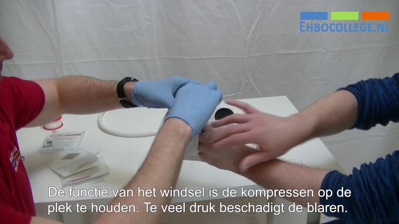 Tweedegraads bevriezing opwarmen en bedekken