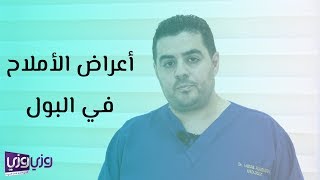 أعراض الأملاح في البول