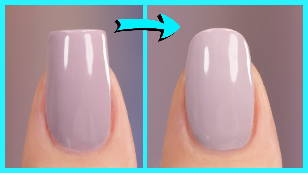 Fingernail Fungus from Acrylic Nails: Causes, Treatment, More