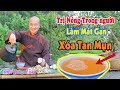 DA SÁNG KHỎE, HẾT MỤN ẨN, MỤN ĐẦU ĐEN /MỤN BỌC, Giải nhiệt nóng trong người Cực Nhanh và Hiệu quả