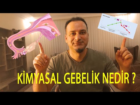 KİMYASAL GEBELİK NEDİR, KİMYASAL GEBELİK BELİRTİLERİ ?