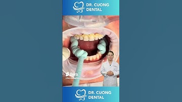 Công Đoạn Quan Trọng Khi Làm Răng Sứ |Dr Cường Official