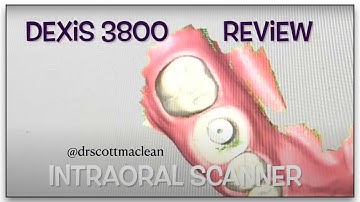 Intra Oral Dexis 3800 Review - Dental