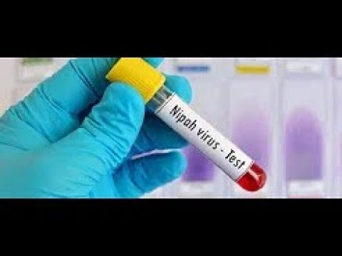 Tehlikeli Nipah Virüsü Nedir? Hurma Yerken Dikkat!