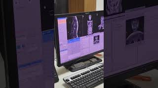 L s spine planing part 2 #radiology #hospital #xray #shortvideo