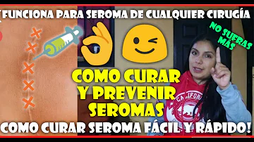 Como tratar seroma tardio?