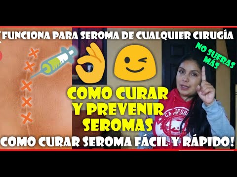 HOW TO CURE EASY AND FAST CESAREA SEROMA AT HOME, WHY IS A SEROMA?  HOW TO PREVENT SEROMA?