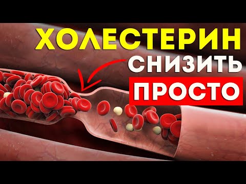 ПРОСТЫЕ способы снижения ХОЛЕСТЕРИНА. Снижения холестерина в домашних условиях. Уровень холестерина.