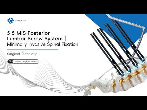 APOLLO 5.5 MIS pedicle screw system video