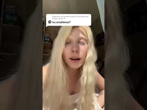 Ты альбинос?