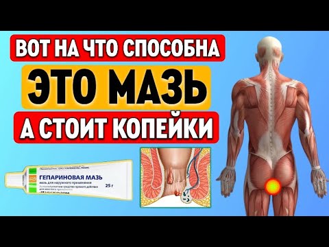 В каких случаях может помочь ГЕПАРИНОВАЯ МАЗЬ? Все способы применения на 1 видео...