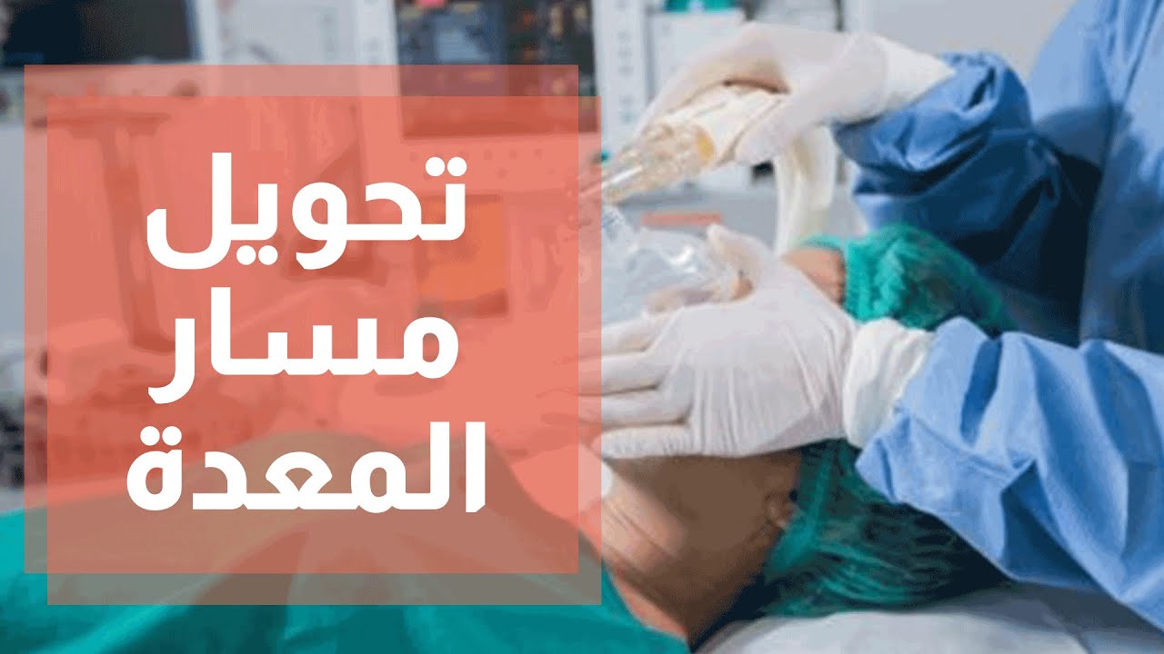 مميزات عملية تحويل مسار المعدة بالمنظار