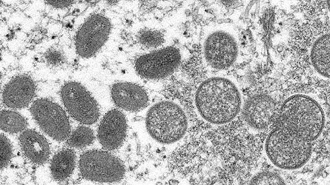 Monkeypox: WHO declares global health emergency over 