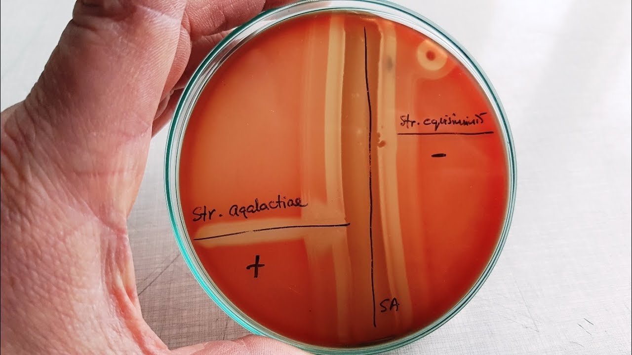 A) The CAMP test for identification of Group B streptococcus