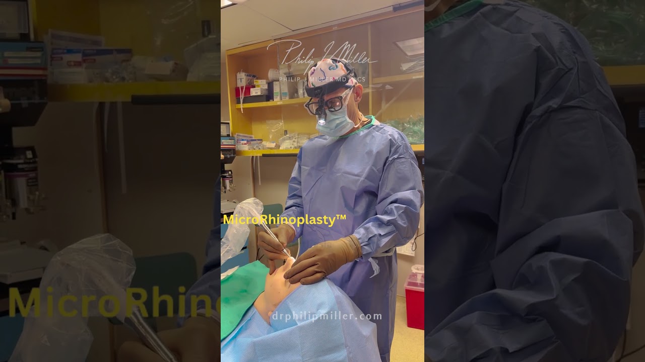 MicroRhinoplasty™! Nose Job Under Local Anesthesia To Remove A Small Bump On Your Nose!