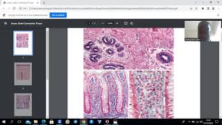 Connective Tissue Proper Histology Summarized