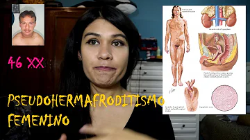 ¿Qué es un pseudohermafrodita?