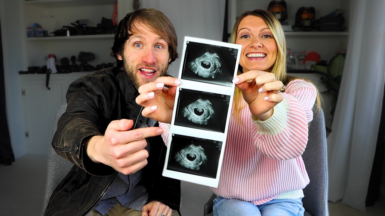 YouTuber buried in backlash after revealing he and wife terminated her pregnancy after discovering baby had Down syndrome: 