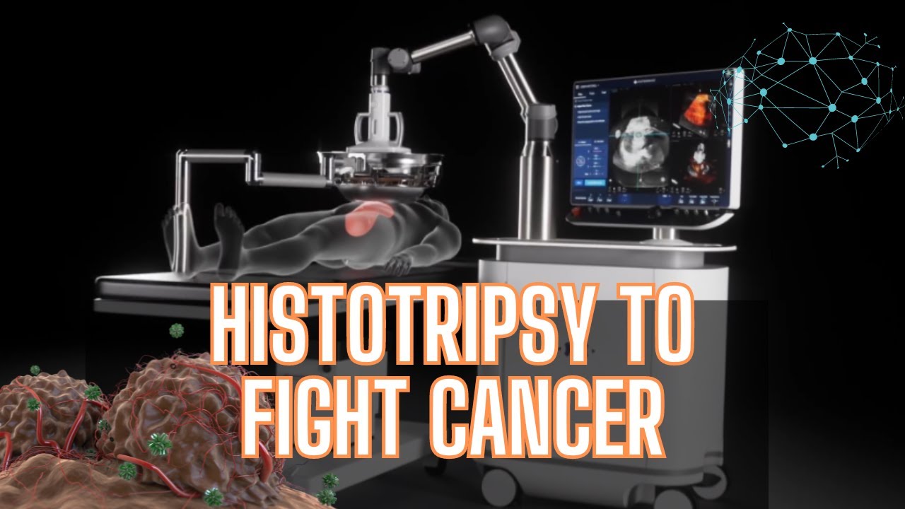 Histotripsy: The Future of Cancer Treatment Unveiled - YouTube