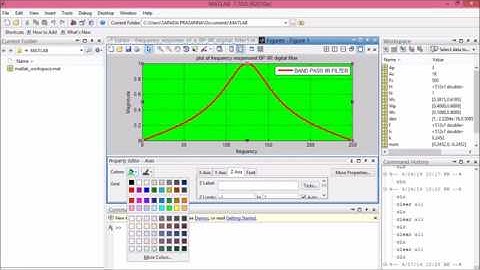 How to plot frequency response of band pass IIR digital filter in matlab by writing programming