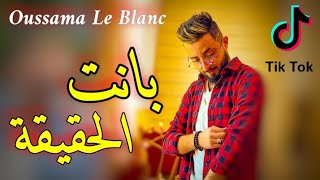 Cheb Oussama Le Blanc Vc Tipo La Novalle - kolchi Kan Kadba - بانت الحقيقة - Kont 3arafha tasrali